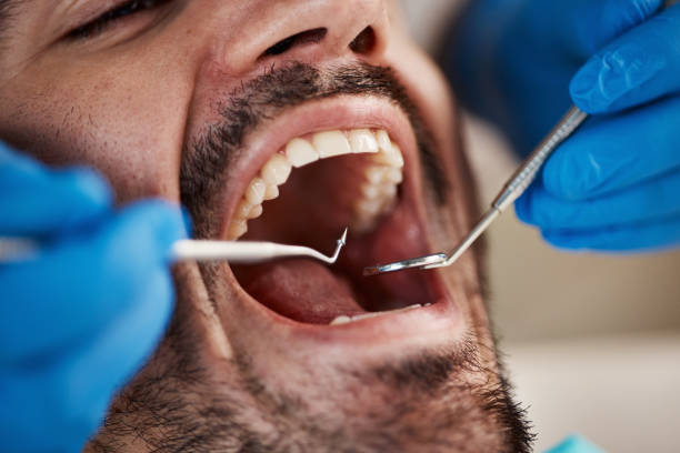 Best Walk-In Emergency Dental Services in Fairfield Plantation, GA
